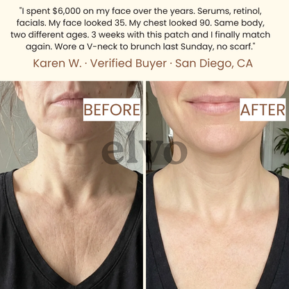 Medical Grade Silicone Chest Patch