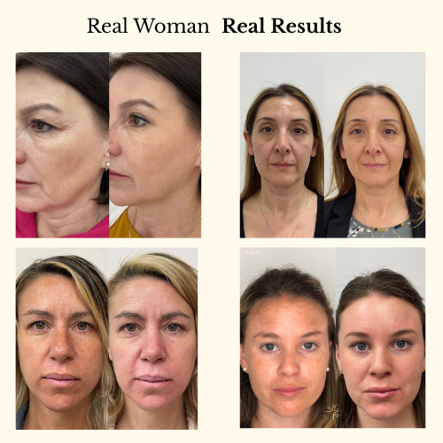 Changing Foundation